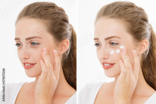 Before-after moisturizing cream. Closeup problem skin portrait Beautiful caucasian woman. Dark circles under eyes, eye bags. Anti aging wrinkles. Skin-care female face. Before after skincare routine photo