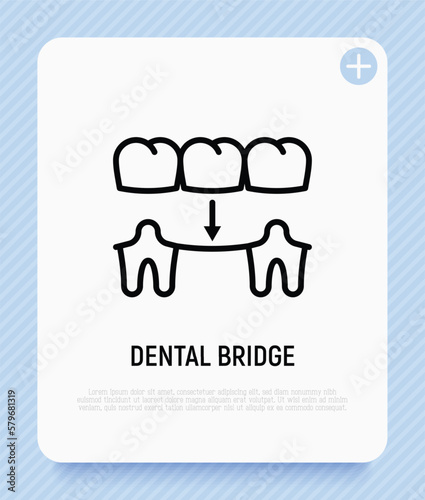 Dental bridge thin line icon. Dentistry, prosthesis. Tooth restoration. Vector illustration.