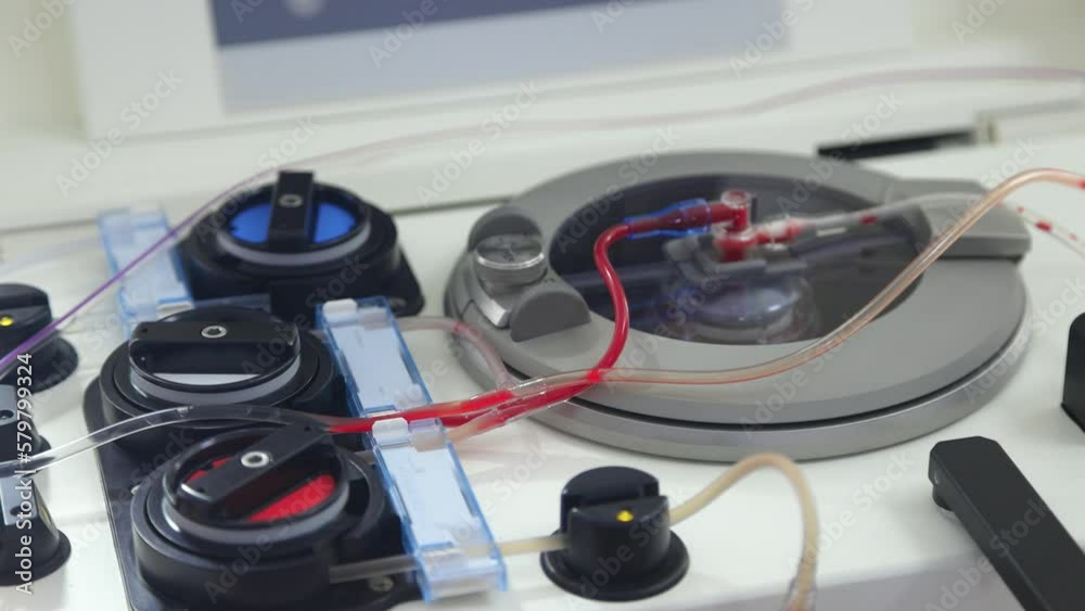 Blood washing machine for wash red blood cells. Blood washing machine for wash red blood cells.