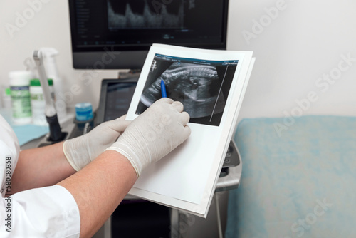 Pregnant woman undergoing ultrasound test at gynecologist office