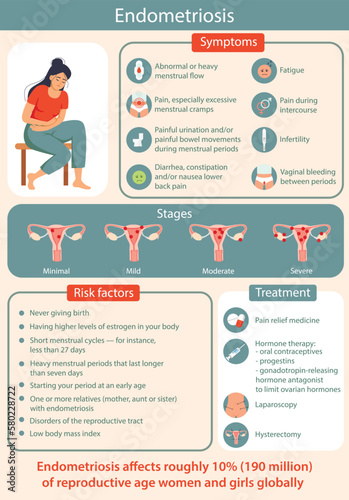 Endometriosis infographic. Detailed vector Infographic. Women Health