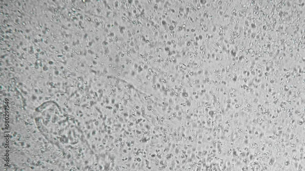 Genetic sample. Reproductive function of man. Slow motion filming of the movement of active spermatozoa under a microscope. Sperm bank. The survival of all mankind. Macro Genetic sample. Reproductive function of man. Slow motion filming of the movement of active spermatozoa under a microscope. Sperm bank. The survival of all mankind. Macro