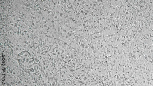 Genetic sample. Reproductive function of man. Slow motion filming of the movement of active spermatozoa under a microscope. Sperm bank. The survival of all mankind. Macro
