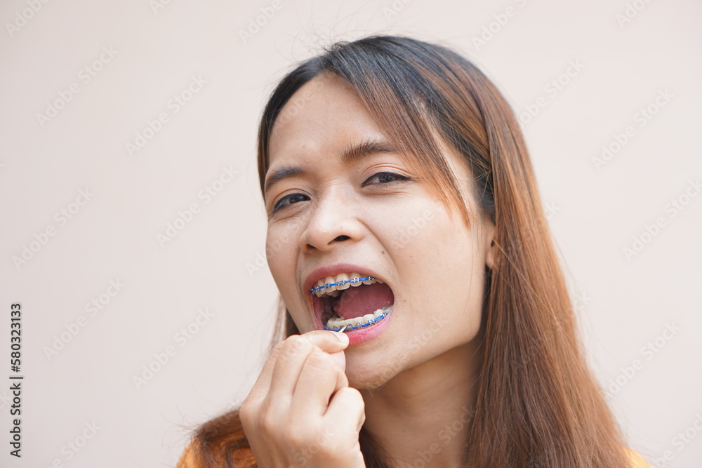 Asian woman picking food scraps from her teeth Asian woman picking food scraps from her teeth