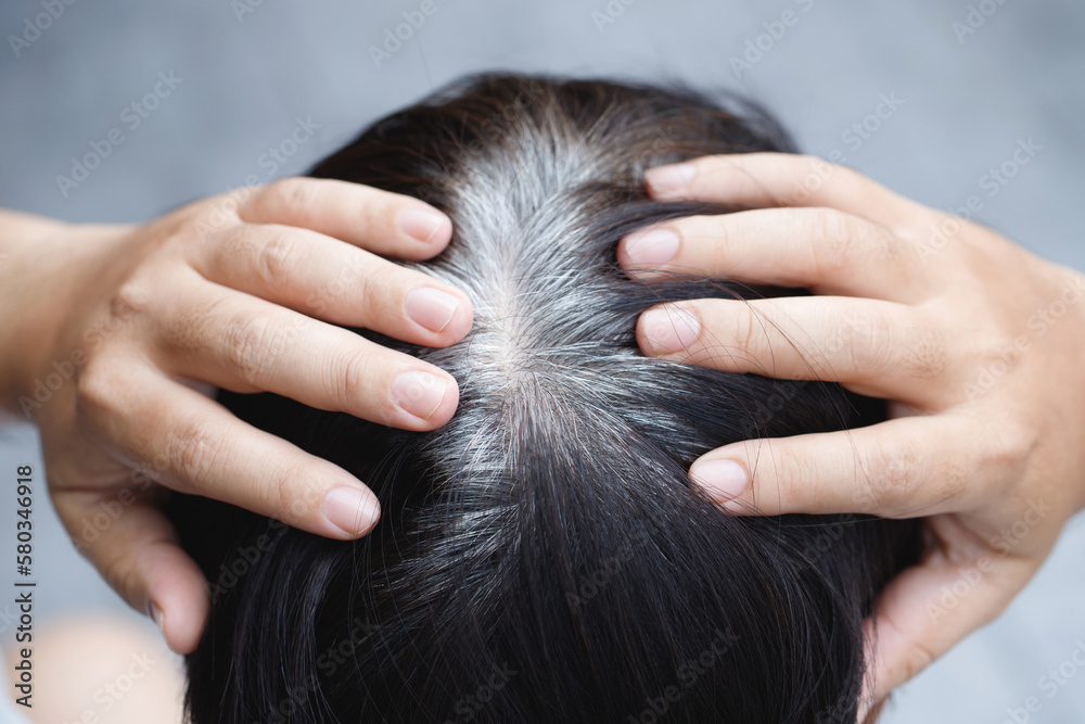 Fototapeta premium Back view of young people premature gray hair, showing black hoary hair roots on head change to senior old man outdoor.