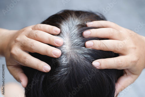 Back view of young people premature gray hair, showing black hoary hair roots on head change to senior old man outdoor.