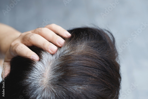 Back view of young people premature gray hair, showing black hoary hair roots on head change to senior old man outdoor.