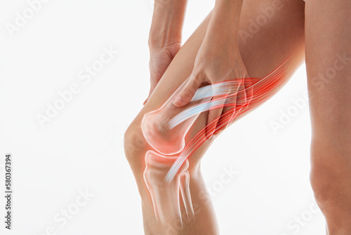 Murais de parede Knee pain, meniscus inflamed, human leg medically accurate representation of an arthritic knee joint