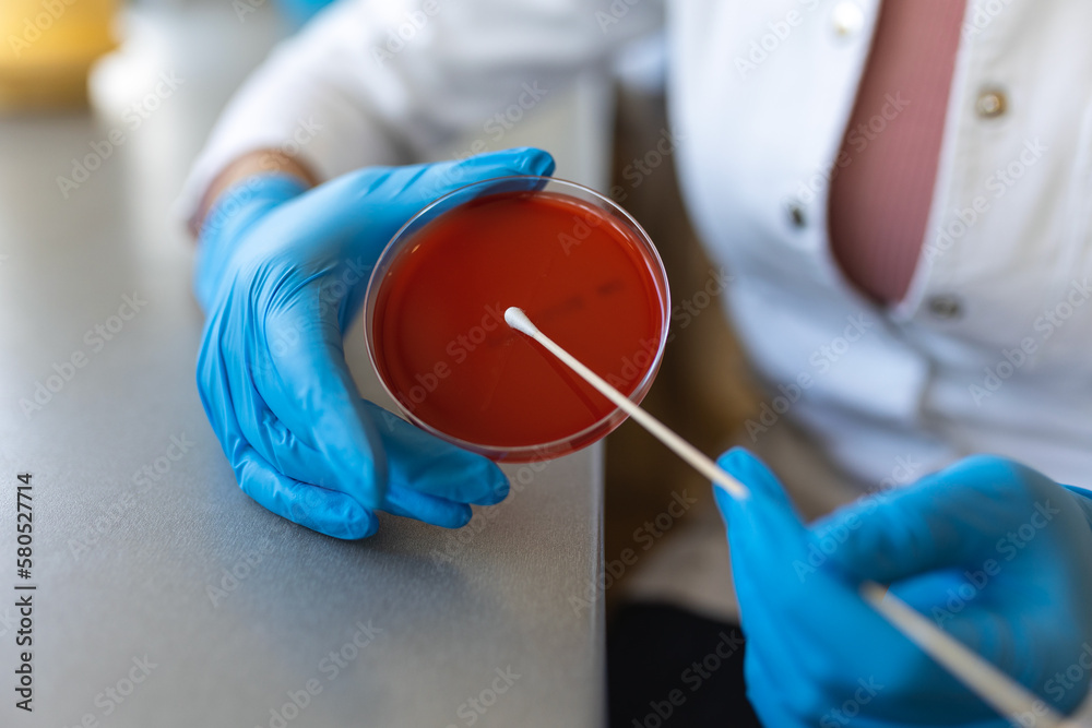 Foto Stock Clean culture of bacteria on agar plate. Selective focus on