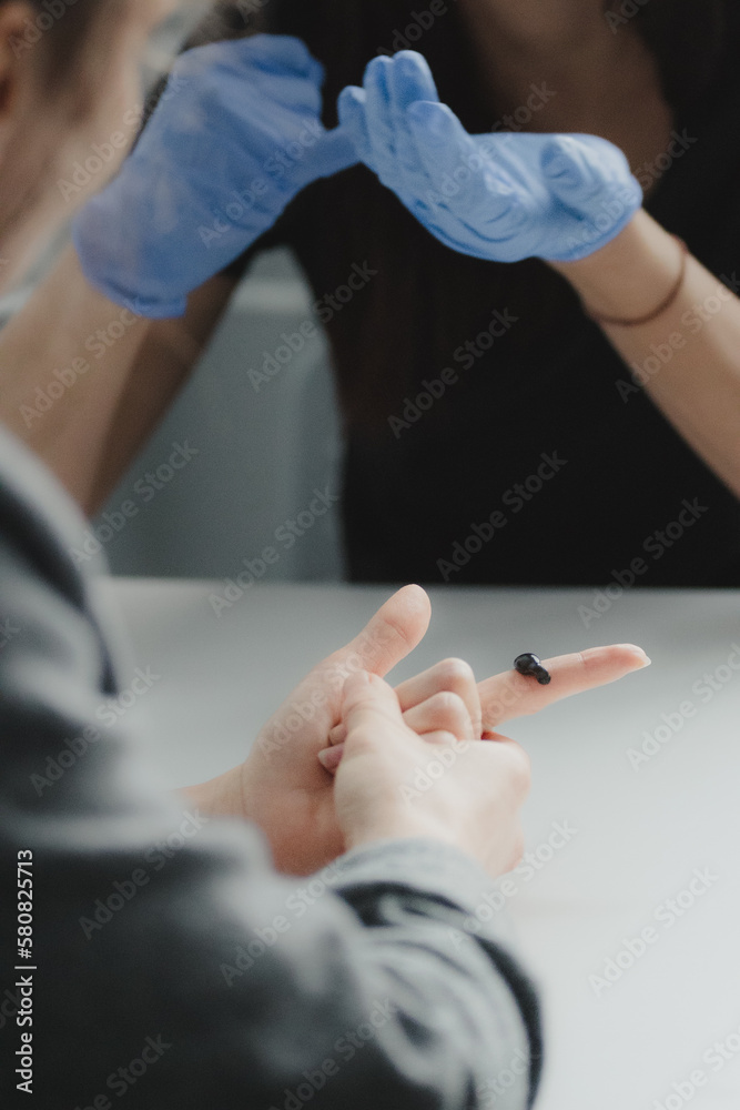 This photo is ideal for use in medical, scientific, or educational purposes such as articles, books, or presentations related to the topic of medical hirudotherapy.