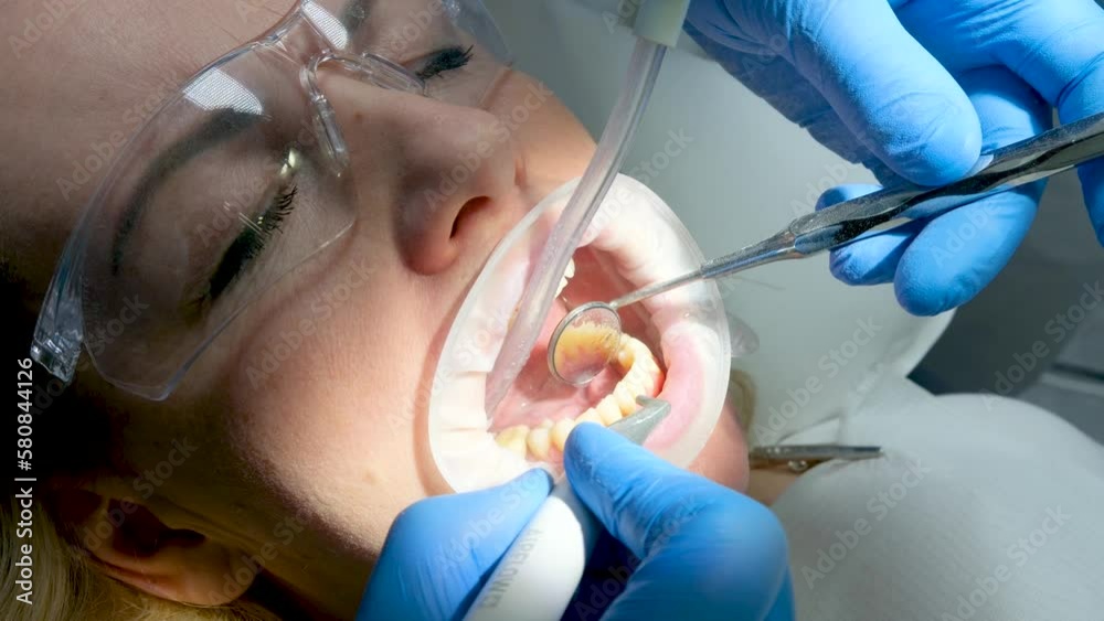 Macro photography. Cleaning process in patient's mouth with cheek