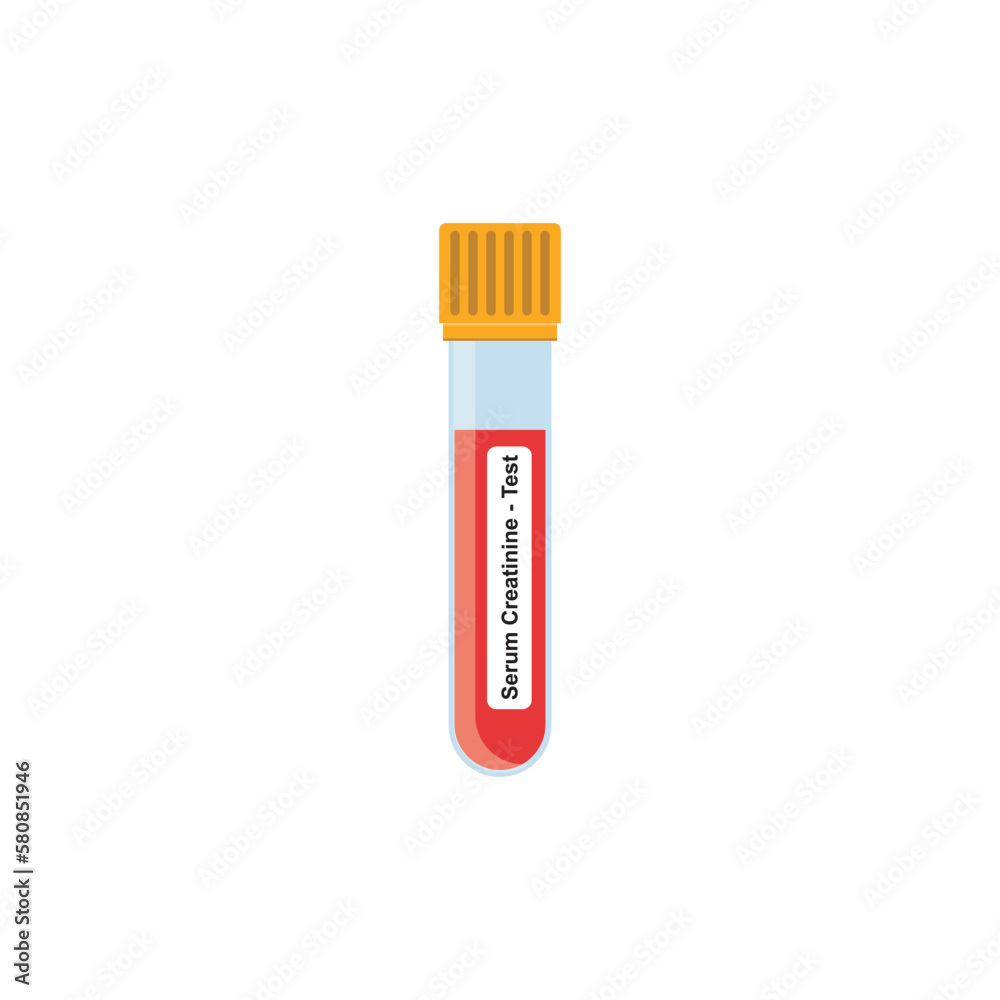 Serum Creatinine Blood Test Concept Design. Vector Illustration. Serum Creatinine Blood Test Concept Design. Vector Illustration.