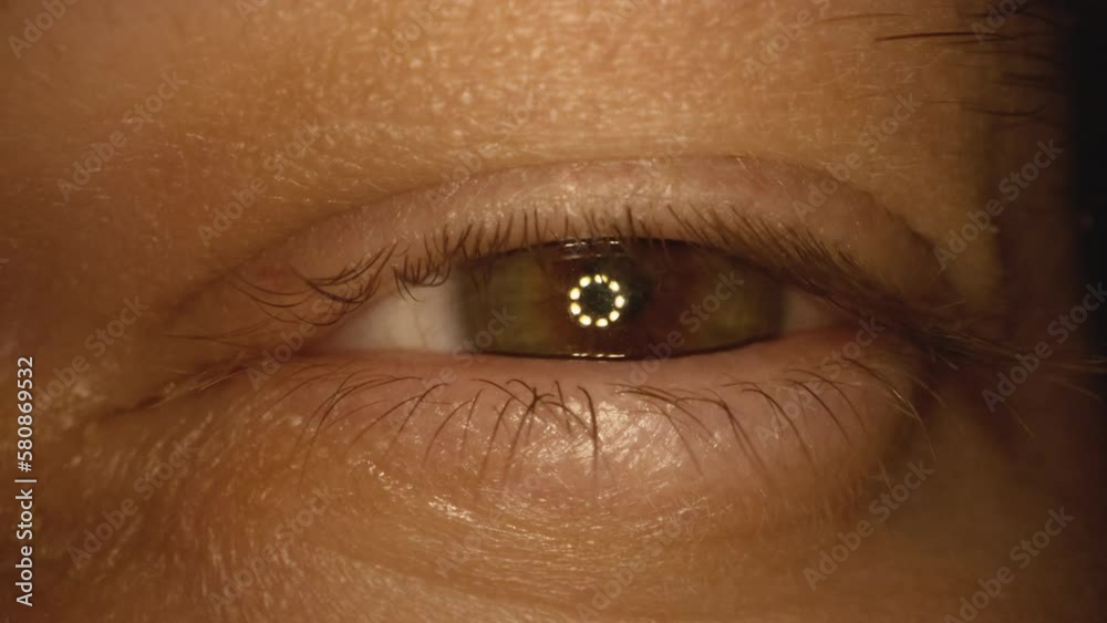 Male patient opens swollen eye with lens placed after surgery trying to