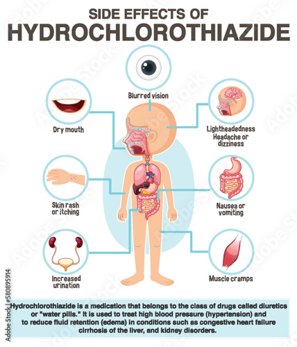 Human anatomy diagram cartoon style of hydrochlorothiazide side effects