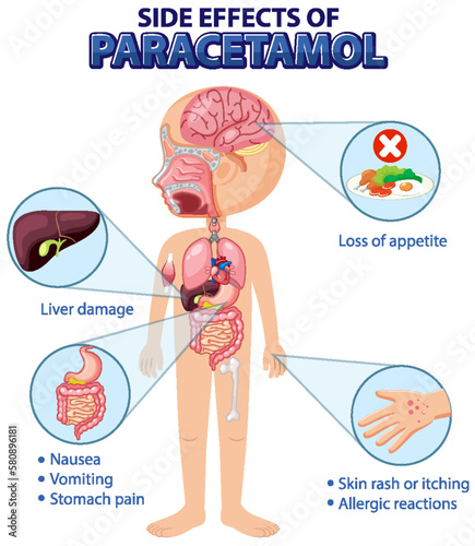 Human anatomy diagram cartoon style of paracetamol side effects