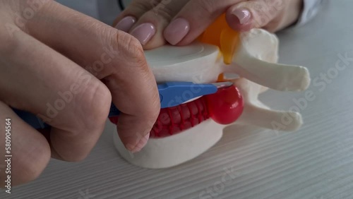 Surgeon shows intervertebral hernia on model to patient concept photo