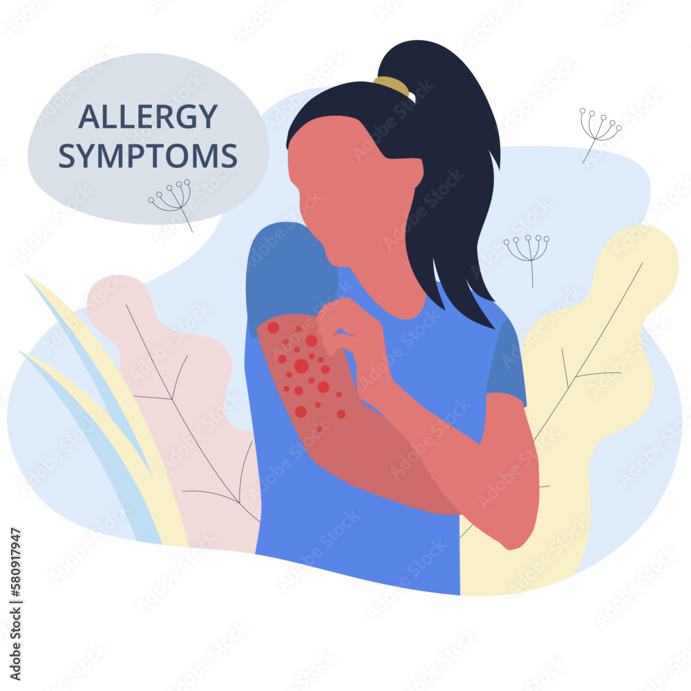 Seasonal allergy. Woman with red skin rash. Woman scratching skin on