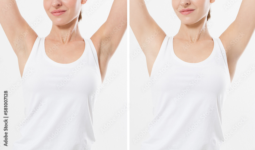 Blank template t shirt. Before after Beauty Woman perfect skin armpits