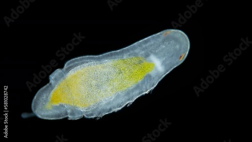 Polychaeta larva under microscope, family Dorvilleidae, possibly genus Ophryotrocha. Sample found in Red Sea photo