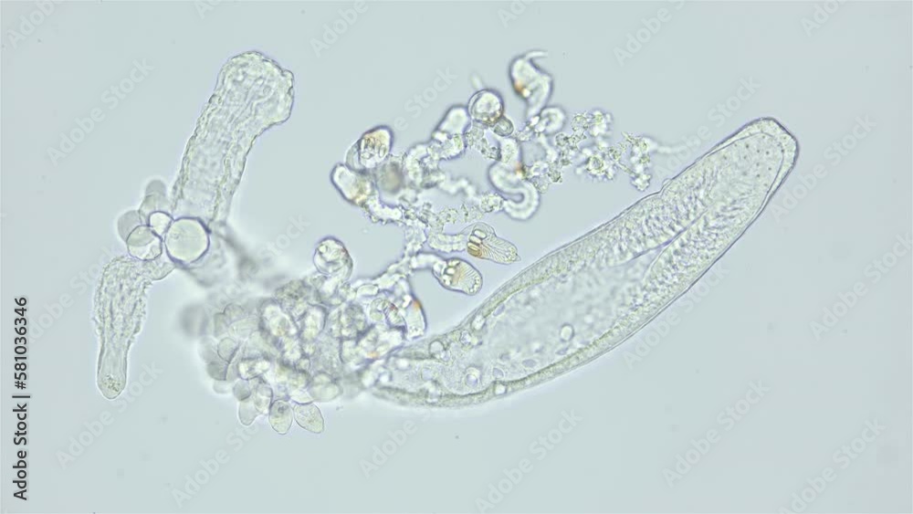 Part of Siphonophora colony under a microscope, class Hydrozoa. Trapping tentacles, gonozoid or gastrozoid are visible. Sample found in Red Sea Part of Siphonophora colony under a microscope, class Hydrozoa. Trapping tentacles, gonozoid or gastrozoid are visible. Sample found in Red Sea