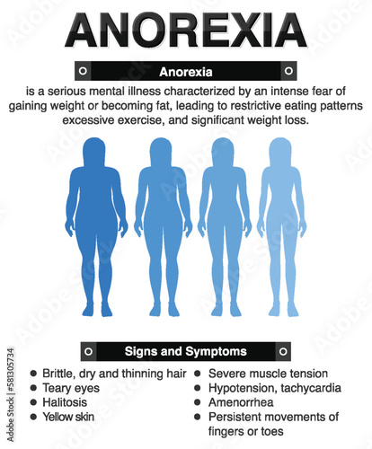 Anorexia (Anorexia) and Its Effects on the Body