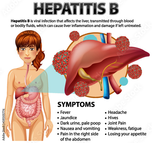 Symptoms of Hepatitis B
