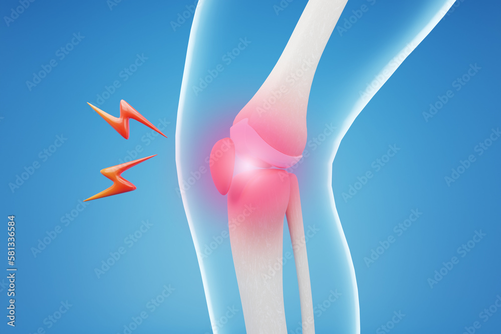 X ray of Knee pain on blue background. 3D rendering. Stock Illustration ...