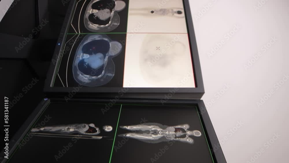 Monitors displaying information of a patient who has been scanned with ...