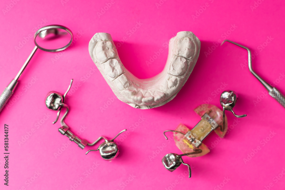 Dental casting gypsum model plaster cast stomatologic human jaws