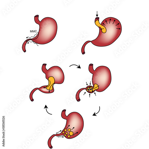 Anatomy & Physiology of the Stomach explanation  vector illustration
