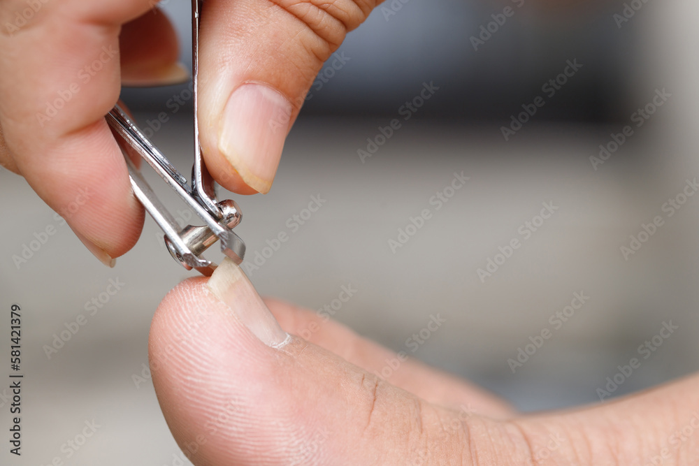 Clean and cut dirty nails to prevent germs and bacteria. Clean and cut dirty nails to prevent germs and bacteria.