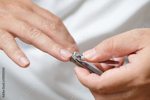 Clean and cut dirty nails to prevent germs and bacteria.