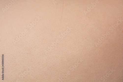 Clear skin surface texture, close up 