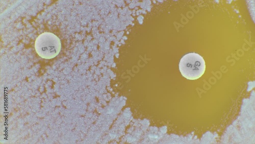 Bacterial colonies are grown in a Petri dish to test for antibiotic resistance. timelapse