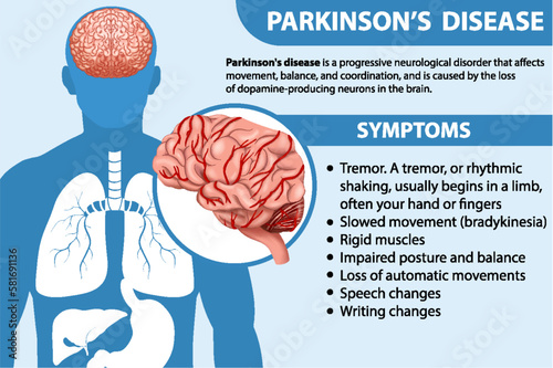 Informative poster of Parkinson disease