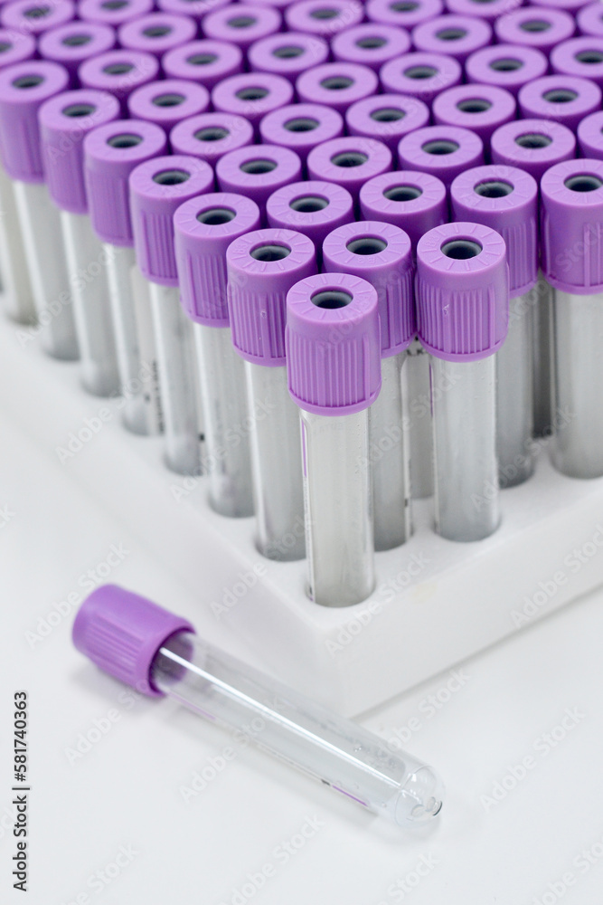 Purple vacuum blood collection tube with EDTA as anticoagulant for