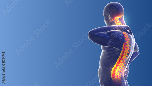 Neck and back joint pain medical background