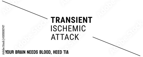 TIA - Transient Ischemic Attack - Mini-stroke with temporary symptoms.