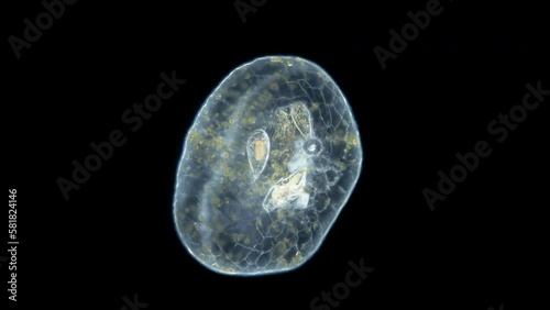 Worm Turbellaria, order Acoela under a microscope. One can see the statocyst: organ of balance and the perchyma, where food is digested. Indian ocean photo