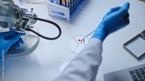 Laboratory scientist taking sample of infected blood to examine  illness diagnostics