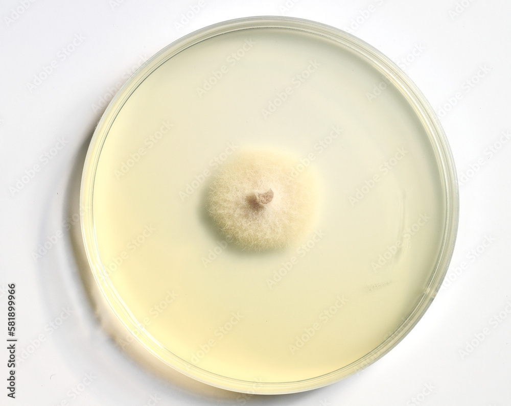 A petri dish with growing cultures of fungi and