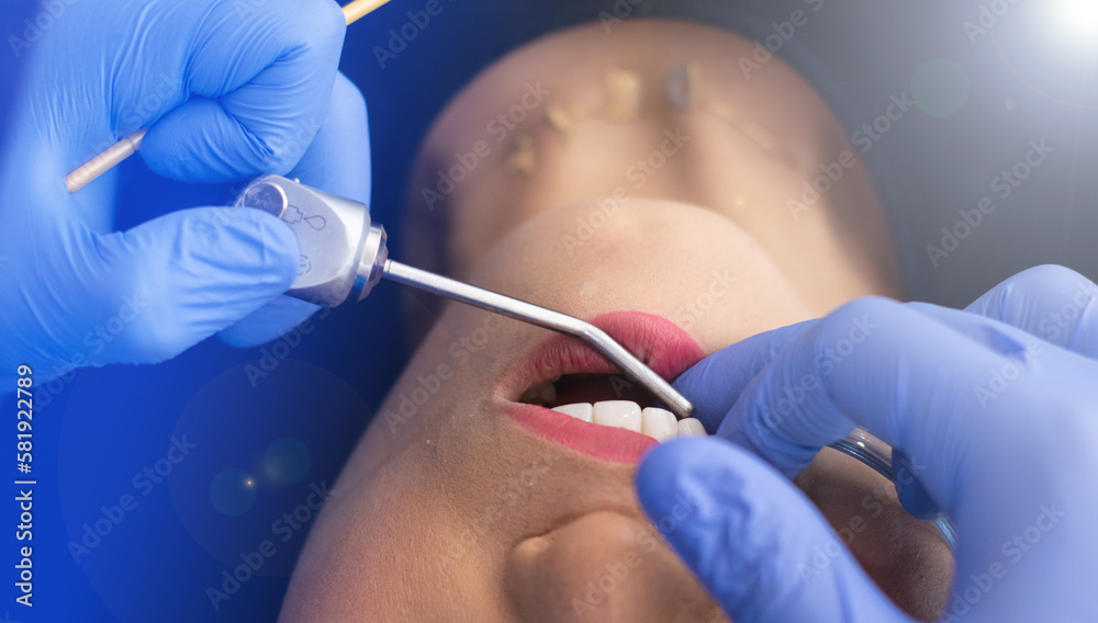 dentist checking the mouth with an appliance dentist checking the mouth with an appliance
