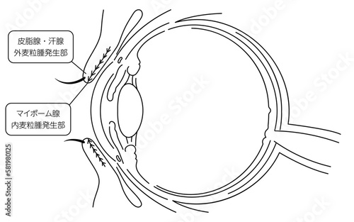 医療イラスト、眼病・ものもらいの発生部についての解剖図