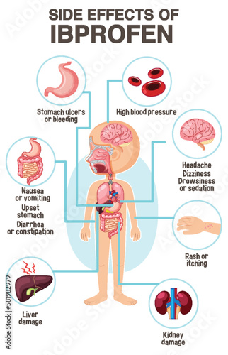 Human anatomy diagram cartoon style of ibuprofen side effects