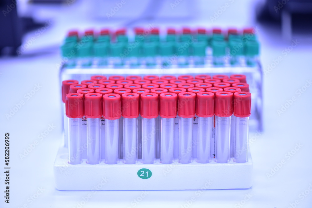 Tubes for collecting blood in medical laboratories. science concept medical Tubes for collecting blood in medical laboratories. science concept medical