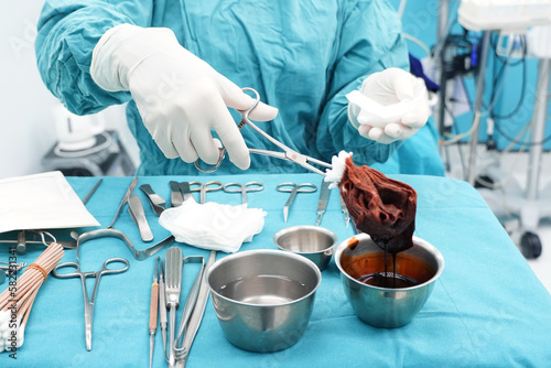 Medical assistant in surgical gown wearing sterile gloves  Tweezers on the antiseptic pack.