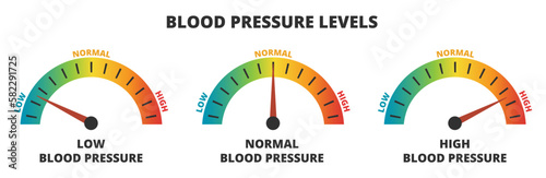 Vector infographic set of blood pressure levels – blood pressure meters with low, normal, and high level results, hypertension. Indicator gauge with color scale and arrow showing blood pressure levels