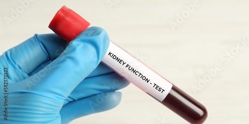 A Scientist or Lab technician holding a tube with a blood sample and labeling the Kidney function test on white background, closeup. Health and medical concept. photo