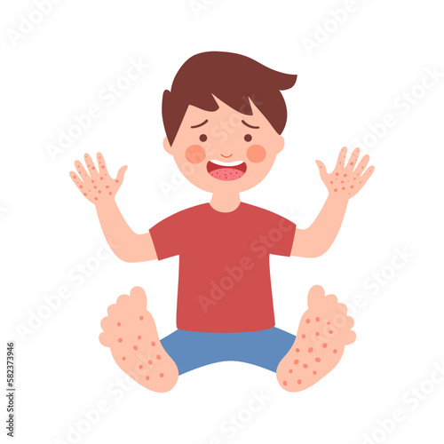 Boy child with hand foot mouth disease in flat design on white background.