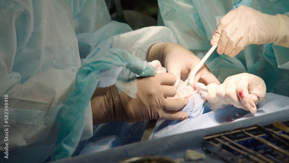 Close-up shot of attentive attentive doctors performing oral surgery in hospital. Dental instruments. Dental clinic. Dental surgery. Slow motion. Close-up shot of attentive attentive doctors performing oral surgery in hospital. Dental instruments. Dental clinic. Dental surgery. Slow motion.